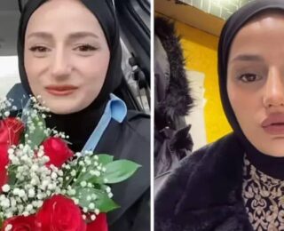Estetik mağduru oldu!  ‘Amin Reis’ lakaplı fenomen Gizem Yıldız’ın yüzü yandı