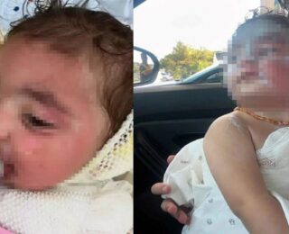 Kreşte facia: Okul ‘Türk kahvesi döküldü’ dedi aile inanmadı: Yanıklar çok daha derin…