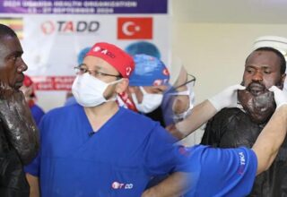 Sakaldan da uzundu! Yüzündeki kitleden Türk doktorları kurtardı!