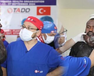 Sakaldan da uzundu! Yüzündeki kitleden Türk doktorları kurtardı!