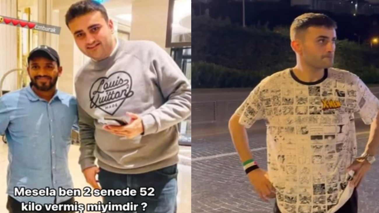 CZN Burak bir deri bir kemik kaldı! 52 kilo veren fenomenin son hali gündem oldu! Ameliyat mı?