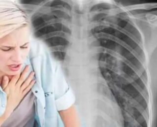 Tıp dünyasında bir ilk: Doktorlar şoke oldu! 18 yaşındaki genç kızın yuttu şeye inanamadılar