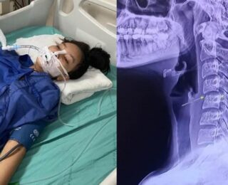 Tayland’da bilinçsiz bir şekilde masaj yaptıran kadın hayatını kaybetti!