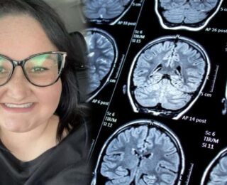 Baş ağrısıyla doktora gitti, hayatının şokunu yaşadı: 18 aylık ömrün kaldı