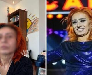 Saçlarını boyamak isteyen Yıldız Tilbe’nin yüzü yandı!