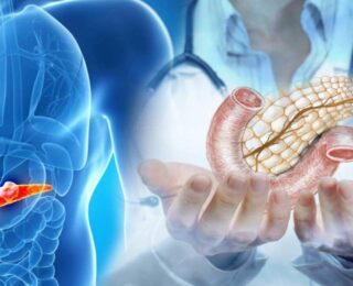 Ünlü doktor pankreas kanseri riskini artıran besinleri açıkladı: DNA hasarına neden oluyor